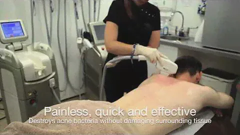 La Belle Forme laser treatments for acne