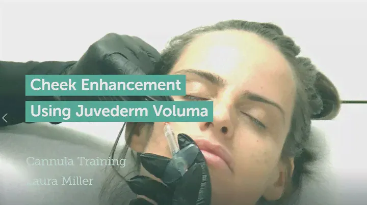 Cheek Enhancement Using Juvederm Voluma Dermal Filler Full Treatment - La Belle Forme Glasgow